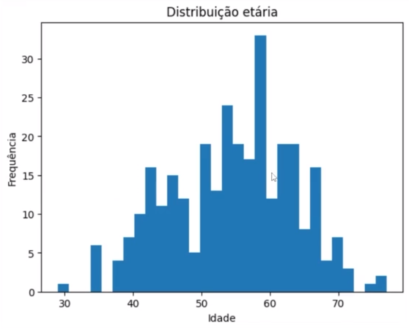 Histograma de distribuição etária com eixo X representando a idade, variando de 30 a 70 anos, e eixo Y representando a frequência, variando de 0 a 30. As barras são predominantemente azuis e variam em altura, sendo a mais alta localizada entre 50 e 60 anos, indicando um pico na distribuição etária nesse intervalo.