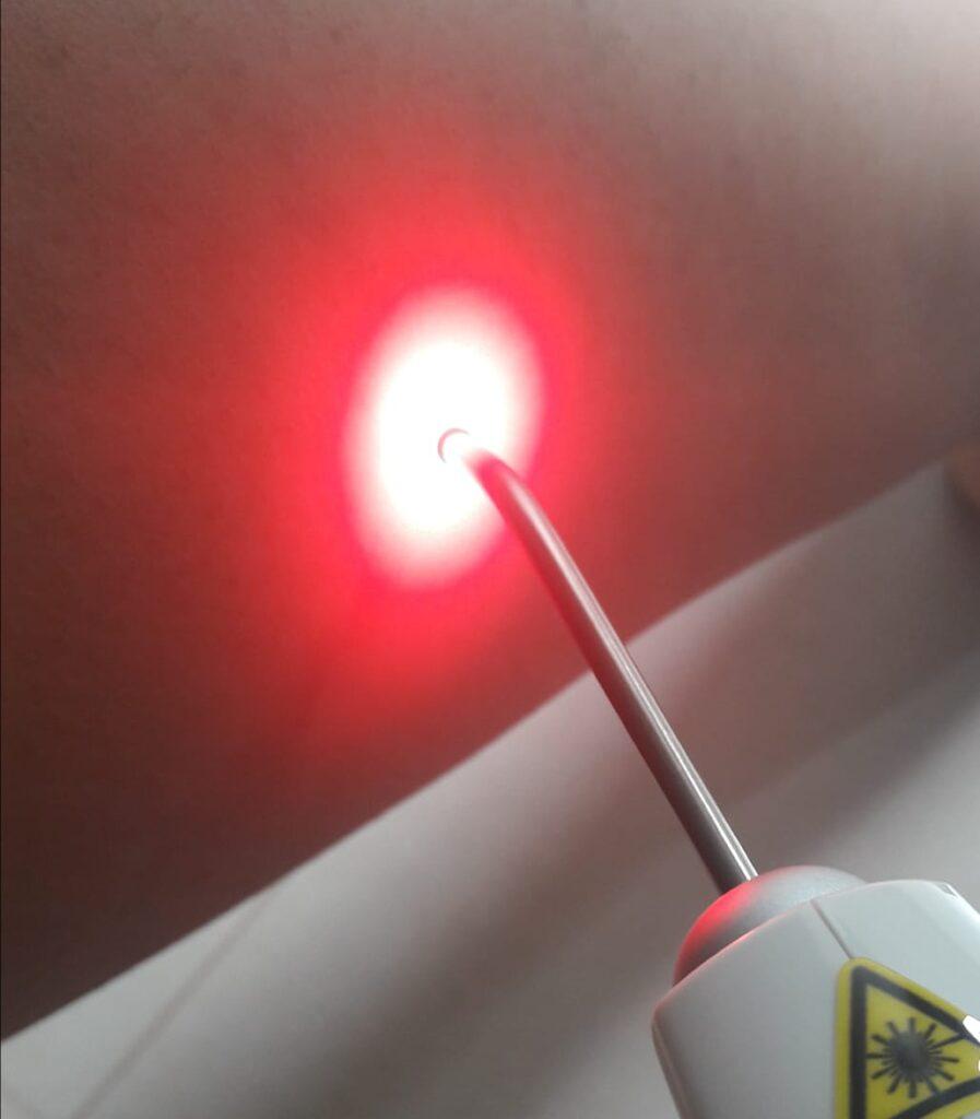 Laserterapia
